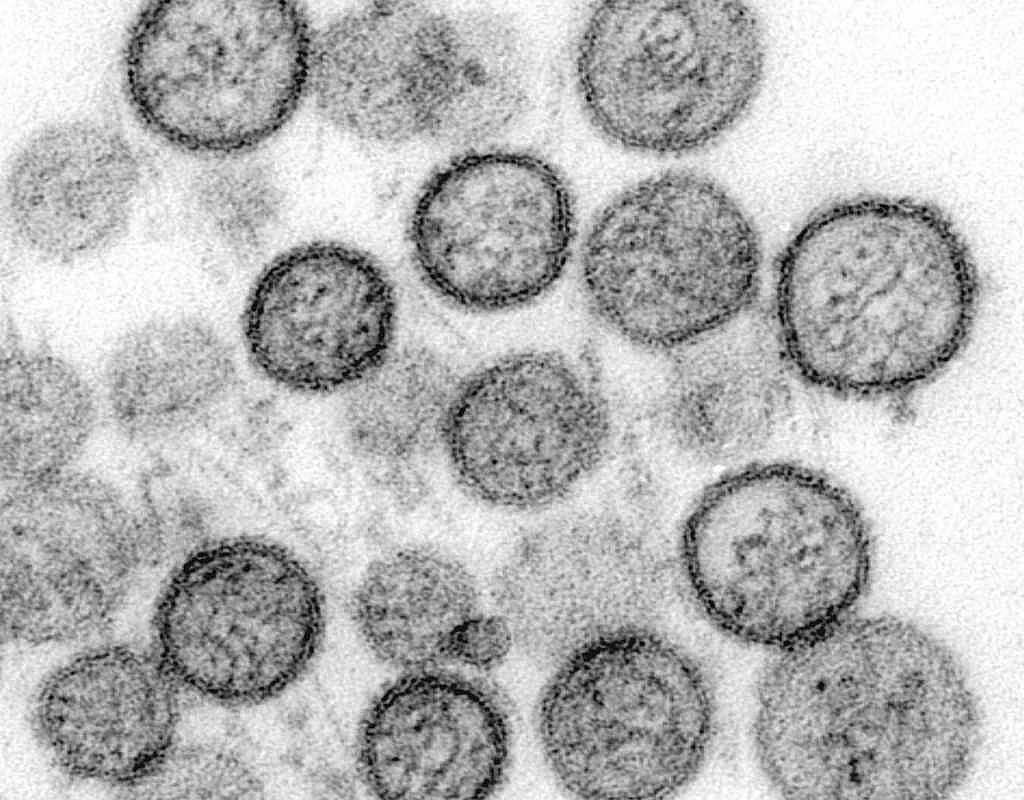 WHO bestätigt: Hantavirus-Ausbruch auf Atlantik-Kreuzfahrt mit Mensch-zu-Mensch-Übertragung